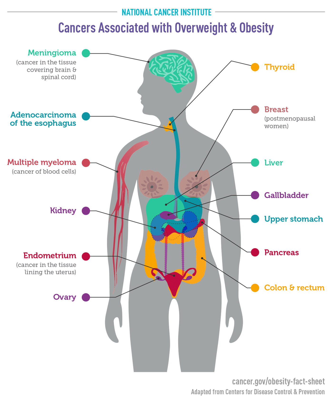 cancers-associated-with-obesity-infographic-NCI.gif