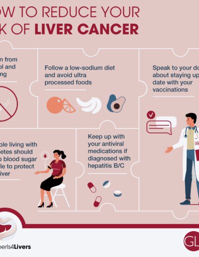 Liver Cancer Risk OI4L 2024 (1)