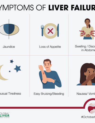 Symptoms Of Liver Failure OI4L 2024 (1)