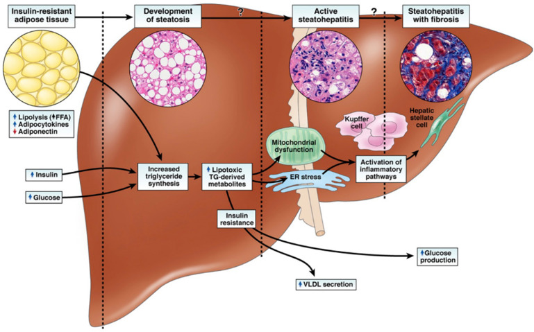 CLD Canadian Journal Of Diabetes Liver Image